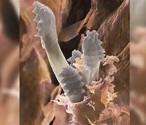 Image result for Face Mites On Human Back