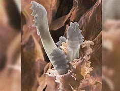 Image result for Mites Living On Face