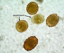 Image result for Ascaris Larvae