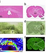 Image result for Brain Tissue Histology