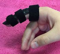 Image result for Volar Aspect Finger