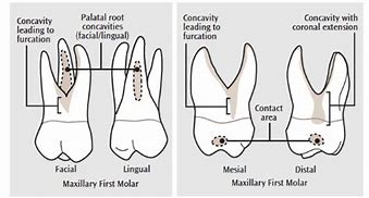 Image result for Molar Tooth Roots