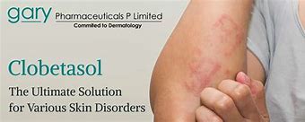 Image result for Clobetasol and Skin Atrophy