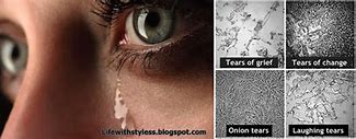 Image result for Happy and Sad Tears Under a Microscope