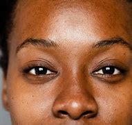 Image result for Skin Darkening