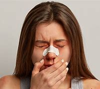 Image result for African Nose Bleed