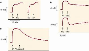 Image result for Vasodilators in Angina Pectoris