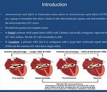 Image result for AV Canal Defect Down Syndrome