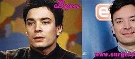 Image result for Jimmy Fallon Plastic Surgery