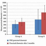 Image result for Inferior Punctum