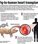 Image result for Pig Heart Transplant