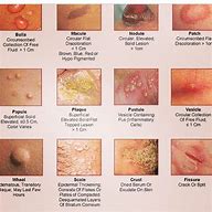 Image result for Diagnose Skin Rash