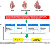 Image result for Pulmonary Edema Fluid Overload