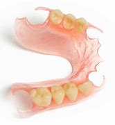 Image result for Valplast Partial One Tooth