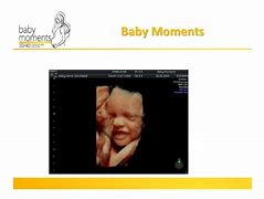 Image result for Baby Scan 3D 4D