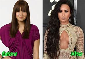 Image result for Demi Lovato Before After