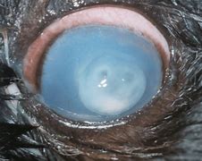 Image result for Corneal Perforation