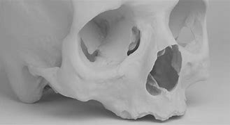 Image result for Real Human Skull 3D Scan