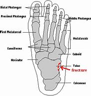 Image result for Medical Foot Anatomy