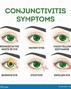 Image result for Symptoms of Eye Infection