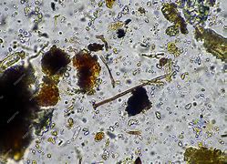 Image result for Fungal Hyphae in Soil