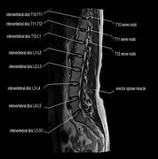 Image result for Dorsal Spine View