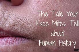 Image result for Mites On Face Rash