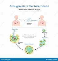 Image result for Bacterium Mycobacterium Tuberculosis