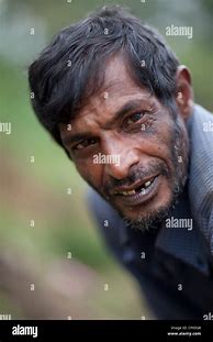 Image result for Tree Man of Sri Lanka