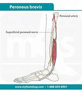 Image result for Peroneus Brevis Attachment