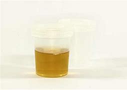 Image result for Muco Urine