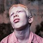 Image result for Child Boy Albino