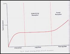 Image result for Propel Tooth Movement