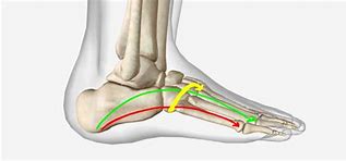 Image result for Three Arches of the Foot