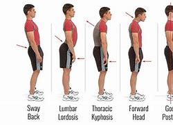 Image result for 5 Proper Standing Posture