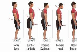 Image result for Slanted Standing Posture