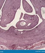 Image result for Uteres Histology