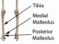 Image result for Posterior Tibial Malleolus