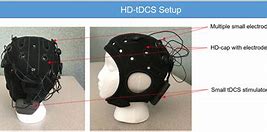 Image result for What Is a tDCS