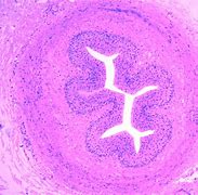 Image result for Ureter Histology Slides Labeled