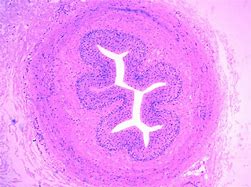 Image result for Uteres Histology