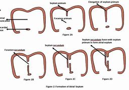 Image result for Interatrial Septum Formation