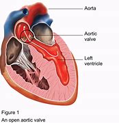 Image result for Aortic Vessels