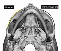 Image result for Cheek Arch