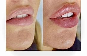 Image result for Lip Reaidng