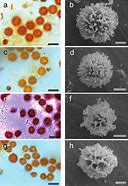 Image result for Scleroderma Microscopic