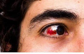 Image result for Blood Shot Clown Eyes