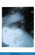 Image result for Stomach in X-ray