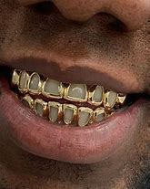 Image result for 10K Gold Grillz