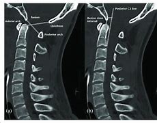 Image result for CT Scan Views